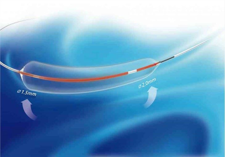 PTA conical balloon catheter